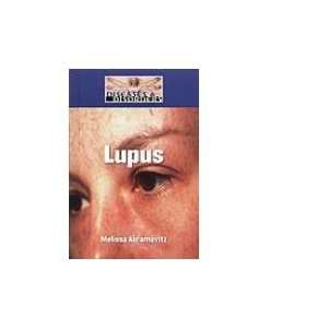  Lupus (9781590189993) Melissa Abramovitz Books
