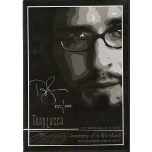  Tony Lucca   Live at Mama Juanas in Los Angeles   Anatomy 