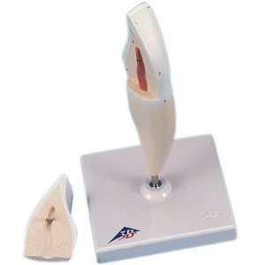 2 Part Lower Incisor