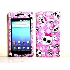  Pink Girl Skull Snap on Hard Protective Cover Case for for 