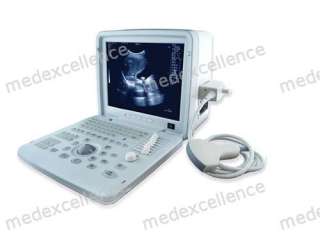 Full Digital Portable Ultrasound Scanner/machine CONVEX  